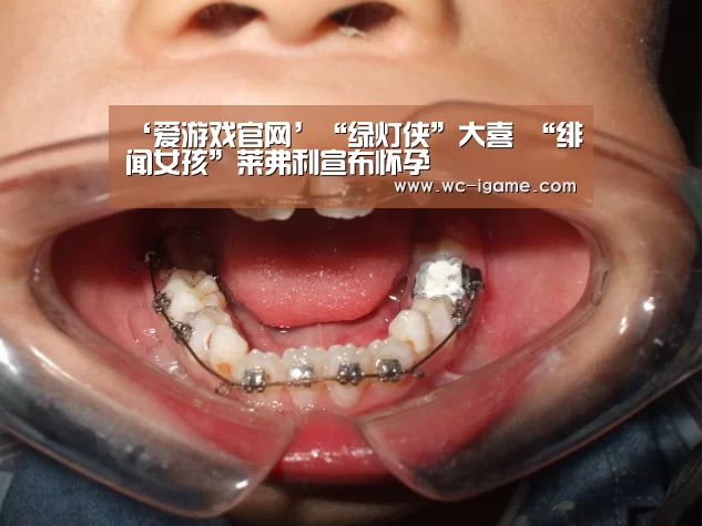 爱游戏体育